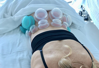 The ancient medicine of Cupping to reduce pain, inflammation and more
